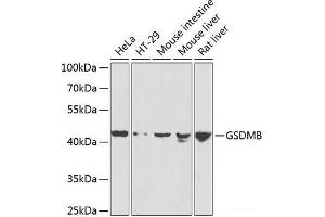 Western blot analysis of extracts of various cell lines using GSDMB Polyclonal Antibody at dilution of 1:1000. (Gasdermin B anticorps)