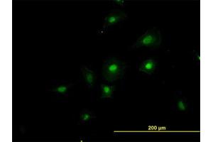 Image no. 2 for anti-RNA Binding Motif Protein 39 (RBM39) (AA 423-473) antibody (ABIN599086) (RBM39 anticorps  (AA 423-473))