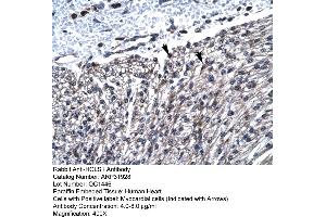Rabbit Anti-HCLS1 Antibody  Paraffin Embedded Tissue: Human Heart Cellular Data: Myocardial cells Antibody Concentration: 4. (HCLS1 anticorps  (N-Term))