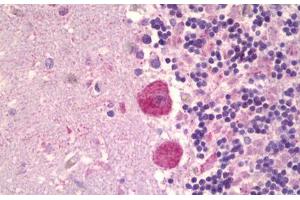 Anti-MAPK15 antibody IHC staining of human brain, cerebellum. (MAPK15 anticorps  (AA 1-245))