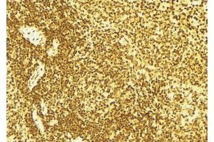 ABIN6269187 at 1/100 staining Mouse spleen tissue by IHC-P. (EIF2AK2 anticorps  (Internal Region))