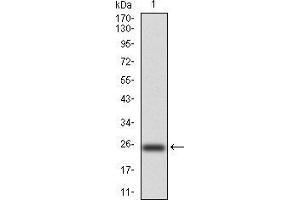 Western Blotting (WB) image for anti-NADPH Oxidase 4 (NOX4) (AA 210-310) antibody (ABIN5872374) (NADPH Oxidase 4 anticorps  (AA 210-310))