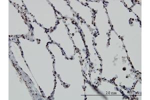 Immunoperoxidase of monoclonal antibody to VDR on formalin-fixed paraffin-embedded human lung.