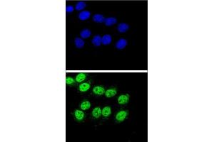 Confocal immunofluorescent analysis of BAG1 Antibody (C-term) (ABIN389451 and ABIN2839520) with Hela cell followed by Alexa Fluor® 488-conjugated goat anti-rabbit lgG (green).