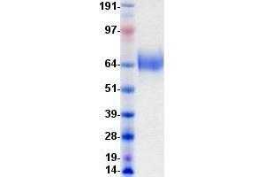 Validation with Western Blot