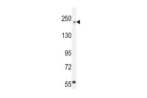 Western blot analysis in U251 cell line lysates (35ug/lane).