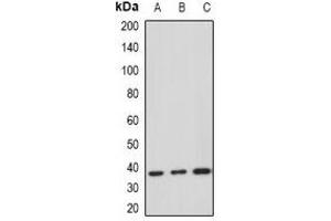 Western blot analysis of HDGF expression in Hela (A), A549 (B), MCF7 (C) whole cell lysates. (HDGF anticorps)