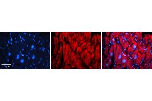 Rabbit Anti-ATP2C1 Antibody   Formalin Fixed Paraffin Embedded Tissue: Human heart Tissue Observed Staining: Cytoplasmic in golgi Primary Antibody Concentration: 1:100 Other Working Concentrations: N/A Secondary Antibody: Donkey anti-Rabbit-Cy3 Secondary Antibody Concentration: 1:200 Magnification: 20X Exposure Time: 0.