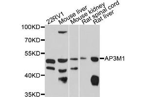 Western blot analysis of extracts of various cell lines, using AP3M1 antibody (ABIN4902920) at 1:1000 dilution. (AP3M1 anticorps)