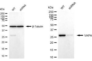 Western blotting analysis using VAPA antibody (ABIN7800821).