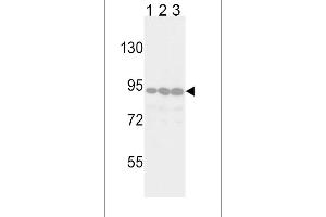 Western blot analysis of TYRO10 Antibody in Jurkat(lane 1), 293(lane 2) and Hela(lane 3) cell line lysates (35ug/lane) (DDR2 anticorps)