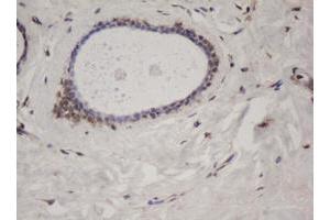 Image no. 1 for anti-Splicing Factor 3a, Subunit 1 (SF3A1) (AA 249-568) antibody (ABIN1491270)