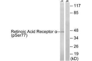 Western blot analysis of extracts from Jurkat cells treated with PMA (125 ng/mL, 30 mins), using Retinoic Acid Receptor α(Phospho-Ser77) antibody. (Retinoic Acid Receptor alpha anticorps  (pSer77))