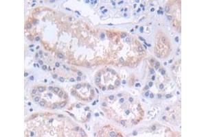 IHC-P analysis of Kidney tissue, with DAB staining. (CXCL12 anticorps  (AA 23-89))