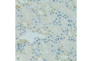 Immunohistochemistry of paraffin-embedded rat kidney using PHOX2B antibody (ABIN5995873) at dilution of 1/100 (40x lens).