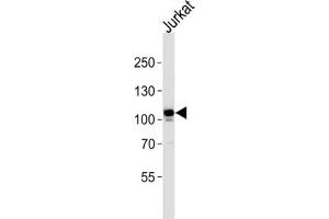Western Blotting (WB) image for anti-C-Mer Proto-Oncogene Tyrosine Kinase (MERTK) antibody (ABIN3003537) (MERTK anticorps)