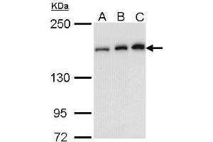 WB Image Sample (30 ug of whole cell lysate) A: A431 , B: H1299 C: Molt-4 , 5% SDS PAGE antibody diluted at 1:1000 (ROCK1 anticorps  (N-Term))