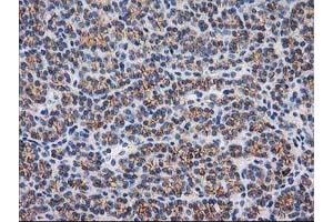 Image no. 8 for anti-Catenin (Cadherin-Associated Protein), beta 1, 88kDa (CTNNB1) antibody (ABIN1496894)