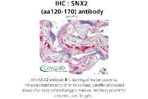 Image no. 1 for anti-Sorting Nexin 2 (SNX2) (AA 120-170) antibody (ABIN1739489)