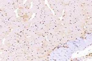 Immunohistochemistry analysis of paraffin-embedded mouse muscle using,TBX10 (ABIN7075814) at dilution of 1: 4600