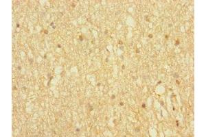 Immunohistochemistry of paraffin-embedded human brain tissue using ABIN7155885 at dilution of 1:100