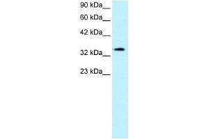 WB Suggested Anti-PAWR Antibody Titration:  0. (PAWR anticorps  (Middle Region))