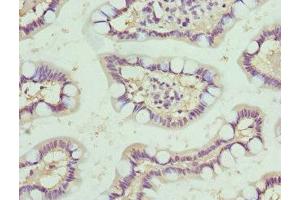 Immunohistochemistry of paraffin-embedded human small intestine tissue using ABIN7161336 at dilution of 1:100