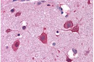 Human Brain, Cortex: Formalin-Fixed, Paraffin-Embedded (FFPE) (IRGC anticorps  (C-Term))