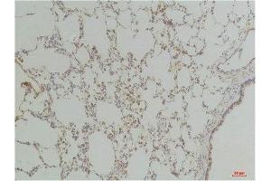 Immunohistochemistry (IHC) analysis of paraffin-embedded Rat LungTissue using Endothelin B ReceptorRabbit Polyclonal Antibody diluted at 1:200. (EDNRB anticorps)