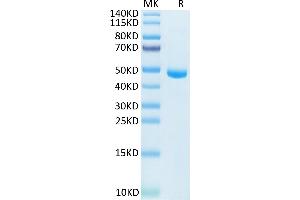 Human IL-20 on Tris-Bis PAGE under reduced condition. (IL-20 Protein (AA 25-176) (Fc Tag))