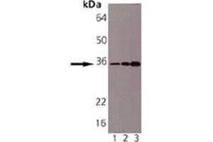 Western blot analysis of Syntaxin 6: Lane 1: CHO-K1, Lane 2: Mouse Brain, Lane 3: Rat Brain. (Syntaxin 6 anticorps)