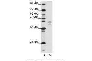 Image no. 2 for anti-Heterogeneous Nuclear Ribonucleoprotein D (HNRNPD) (AA 61-110) antibody (ABIN203267) (HNRNPD/AUF1 anticorps  (AA 61-110))
