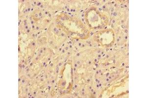 Immunohistochemistry of paraffin-embedded human kidney tissue using ABIN7171500 at dilution of 1:100 (TNKS2 anticorps  (AA 1-246))