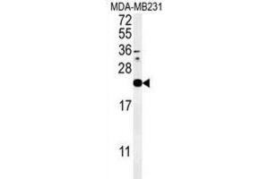 Western Blotting (WB) image for anti-Interleukin 1 Family, Member 6 (IL1F6) antibody (ABIN3002274)