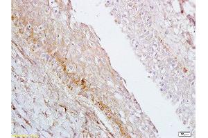 Formalin-fixed and paraffin embedded rat ovary tissue labeled with Anti-AGPAT4 Polyclonal Antibody, Unconjugated  at 1:200 followed by conjugation to the secondary antibody, (SP-0023), and DAB staining