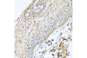 Immunohistochemistry of paraffin-embedded human esophagus using NDUFA2 antibody. (NDUFA2 anticorps  (AA 1-95))