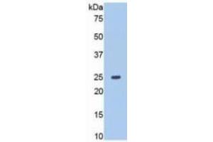 WB of Protein Standard: different control antibodies  against Highly purified E. (MMP13 Kit ELISA)