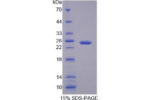 SDS-PAGE of Protein Standard from the Kit  (Highly purified E.