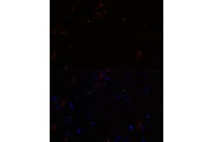 Immunofluorescence analysis of rat brain using KIF17 antibody (ABIN7268123) at dilution of 1:100. (KIF17 anticorps  (AA 360-660))