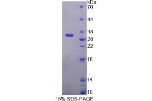 Image no. 1 for POU Class 5 Homeobox 1 (POU5F1) (AA 136-360) protein (His tag) (ABIN4988419) (OCT4 Protein (AA 136-360) (His tag))