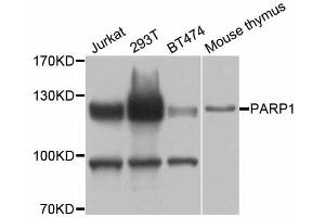 Western blot analysis of extracts of various cell lines, using PARP1 antibody (ABIN5998456) at 1/1000 dilution. (PARP1 anticorps)