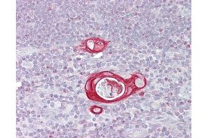 Anti-FAIM / FAIM1 antibody IHC of human thymus.