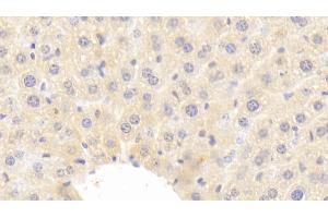 anti-Insulin-Like Growth Factor 1 (IGF1) (AA 49-153) antibody