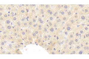 Detection of IGF1 in Mouse Liver Tissue using Polyclonal Antibody to Insulin Like Growth Factor 1 (IGF1) (IGF1 anticorps  (AA 49-153))