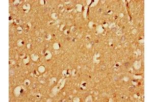 Immunohistochemistry of paraffin-embedded human brain tissue using ABIN7152417 at dilution of 1:100 (FBXO25 anticorps  (AA 1-291))