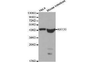 Western blot analysis of extracts of various cell lines, using KRT20 antibody. (KRT20 anticorps  (AA 245-424))