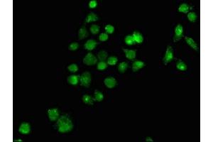 Immunofluorescence staining of PC-3 cells with ABIN7163013 at 1:100, counter-stained with DAPI.