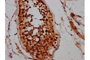 IHC image of ABIN7146463 diluted at 1:200 and staining in paraffin-embedded human testis tissue performed on a Leica BondTM system. (Calicin anticorps  (AA 240-351))