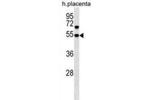Western Blotting (WB) image for anti-Sorting Nexin Family Member 30 (SNX30) antibody (ABIN3000293) (SNX30 anticorps)