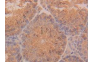 Detection of CK18 in Mouse Testis Tissue using Polyclonal Antibody to Cytokeratin 18 (CK18)